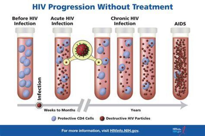 HIV step 5