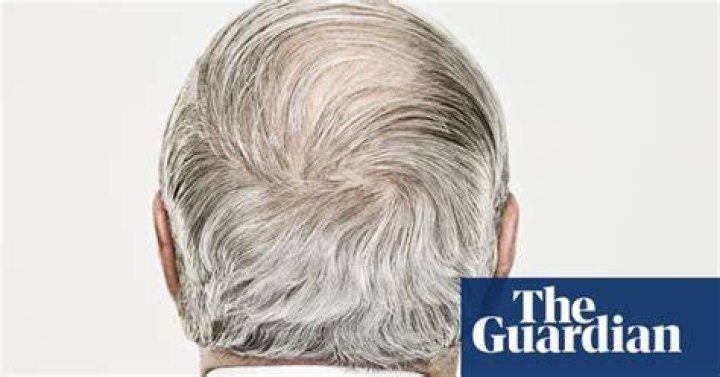 Scientists may have discovered why hair turns grey | Science